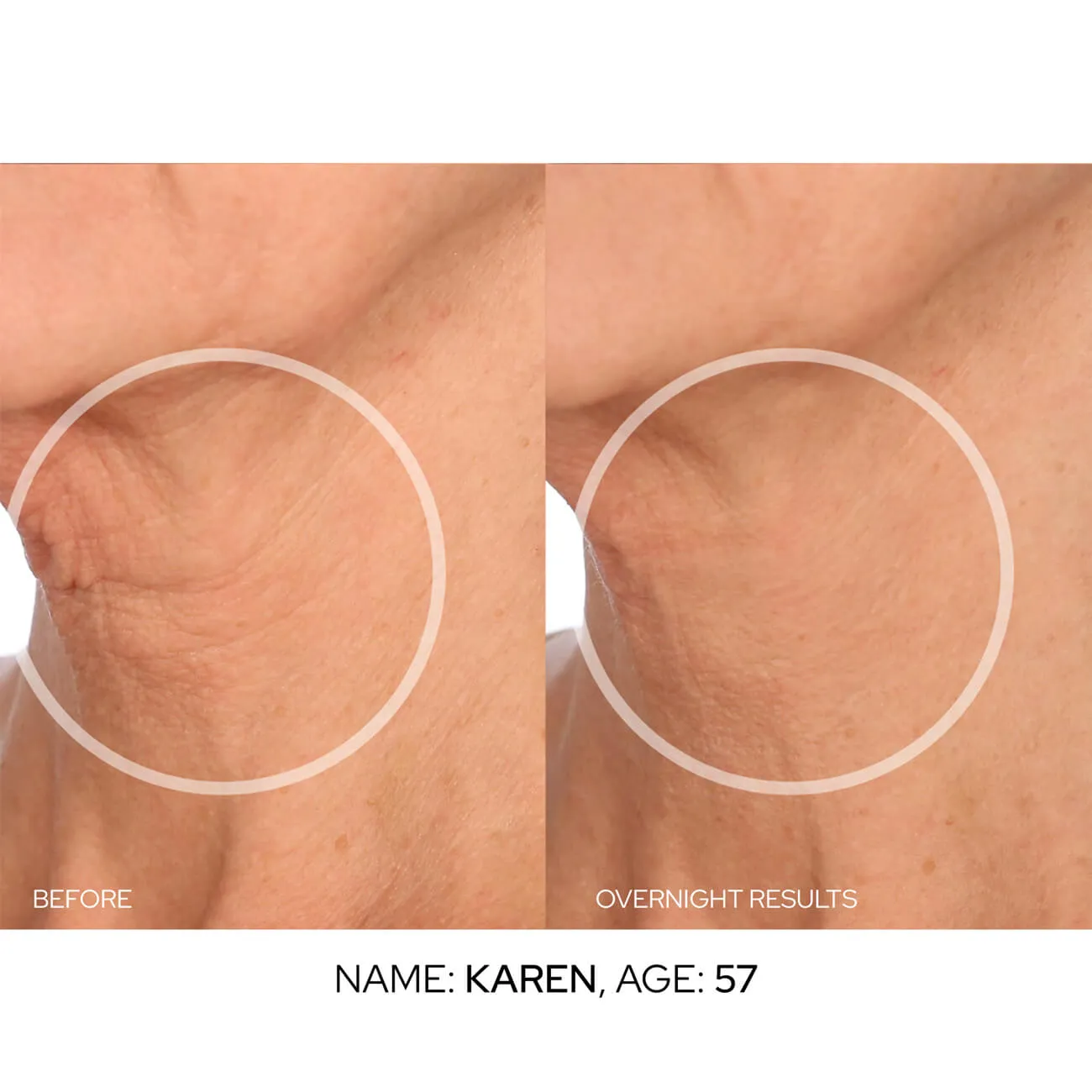 FaceLift Value Packs