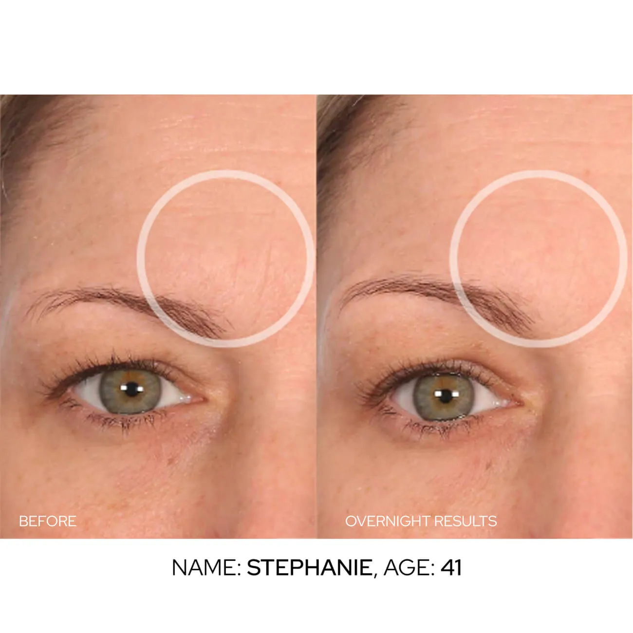 FaceLift Value Packs