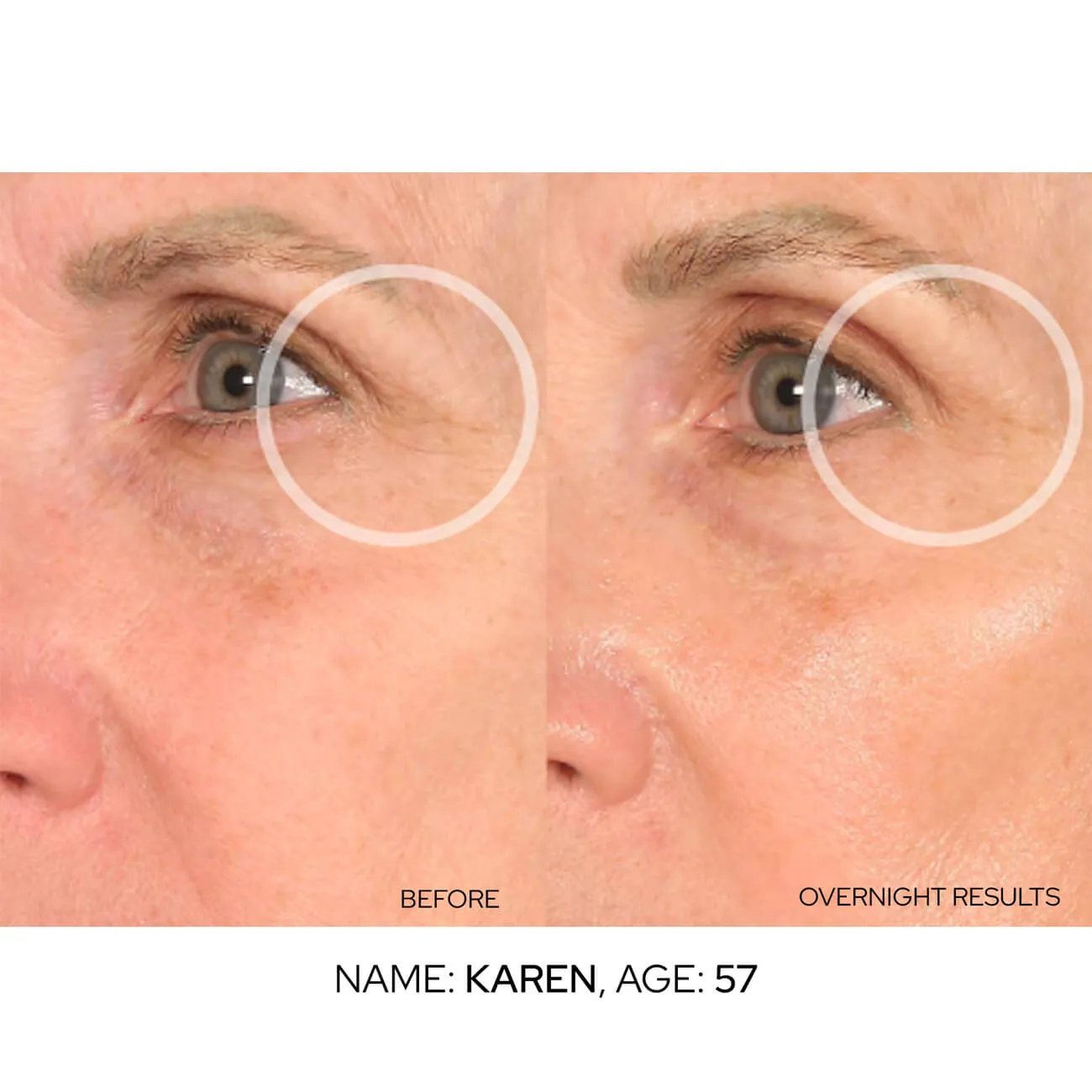 FaceLift Value Packs